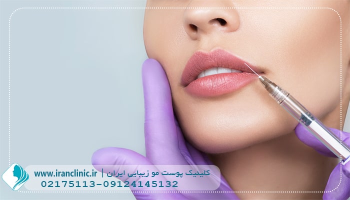 تزریق ژل در سعادت آباد