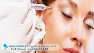 تزریق بوتاکس در سعادت آباد