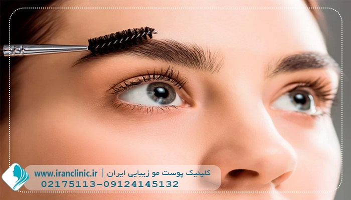 کاشت ابرو در سعادت آباد