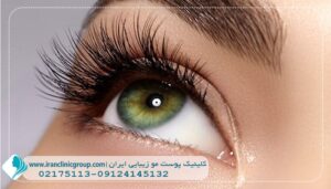 روش های افزایش رشد مژه‌ها