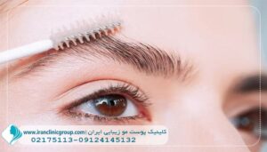 ترمیم کاشت ابرو