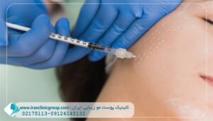 مزوتراپی در سعادت آباد