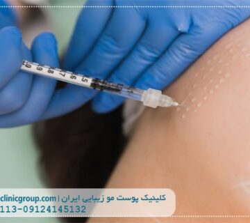 مزوتراپی در سعادت آباد