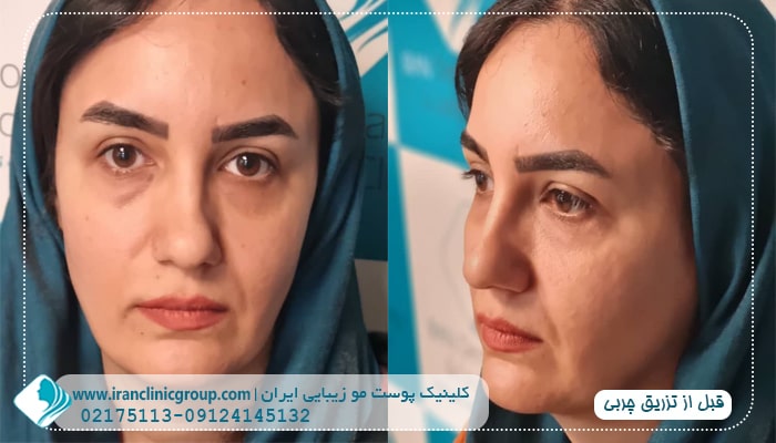 بهترین کلینیک برای جوانسازی پوست در سعادت آباد