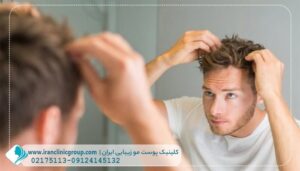 کاشت مو به روش FUT