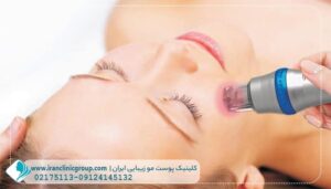 آر اف فرکشنال در سعادت آباد