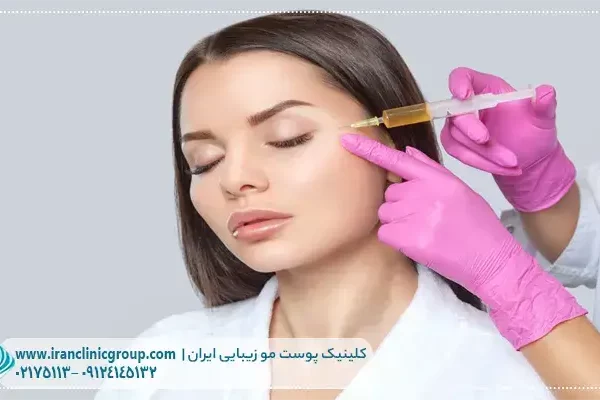 پی ار پی prp در شهرک غرب