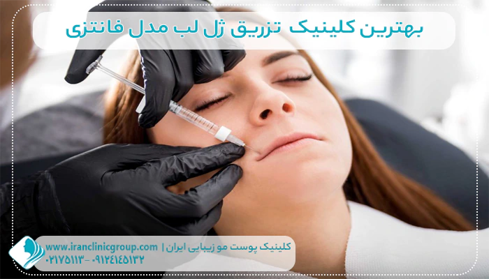 بهترین کلینیک تزریق ژل لب مدل فانتزی