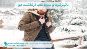 تاثیر گرما و سرما بعد از کاشت مو