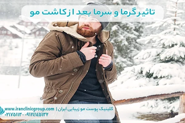 تاثیر گرما و سرما بعد از کاشت مو