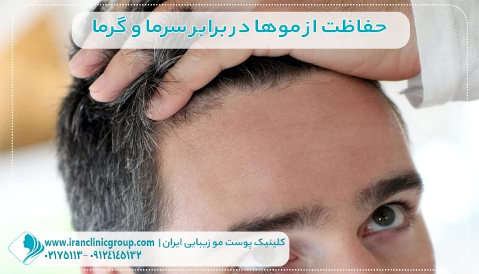 حفاظت از موهای کاشته شده در برابر سرما و گرما