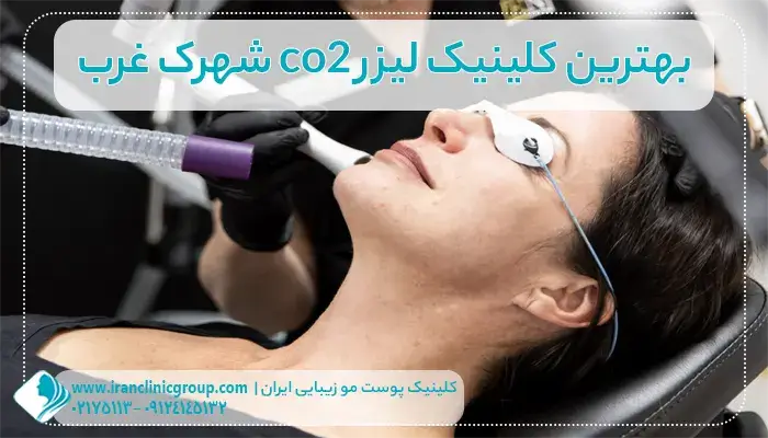 بهترین کلینیک لیزر co2 شهرک غرب