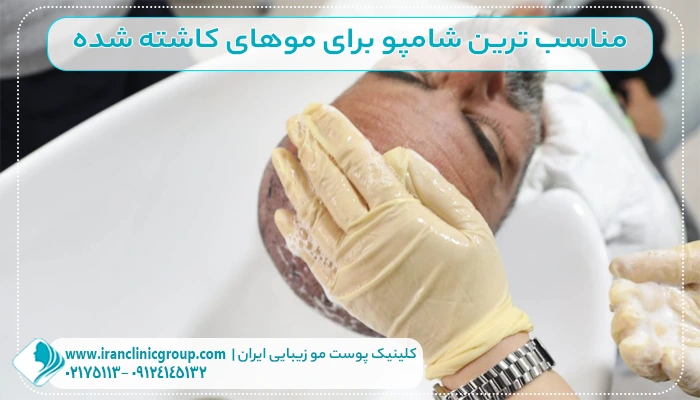 مناسب ترین شامپو برای موهای کاشته شده