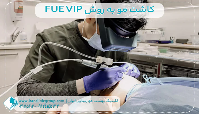 کاشت مو به روش FUE VIP