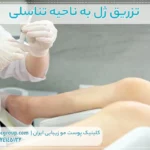 تزریق ژل به ناحیه تناسلی