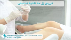 تزریق ژل به ناحیه تناسلی