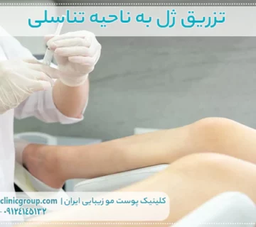 تزریق ژل به ناحیه تناسلی