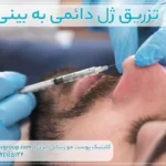 تزریق ژل دائمی به بینی