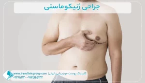 ژنیکوماستی1