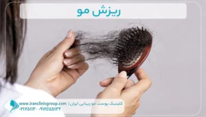 ریزش مو