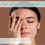 ژل اکنومیس برای جای جوش