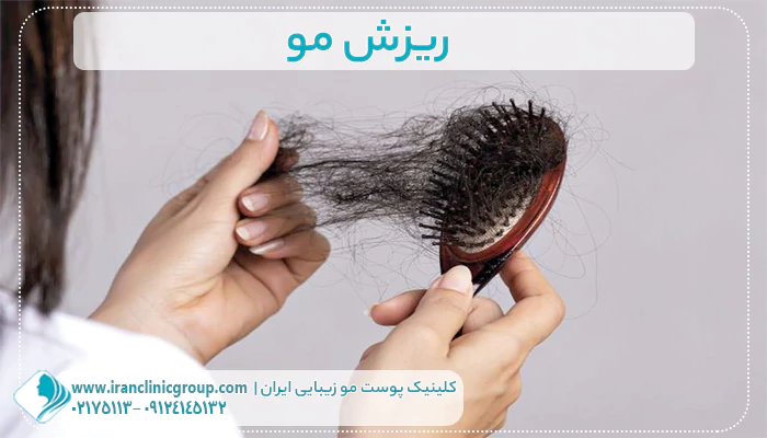 ریزش مو