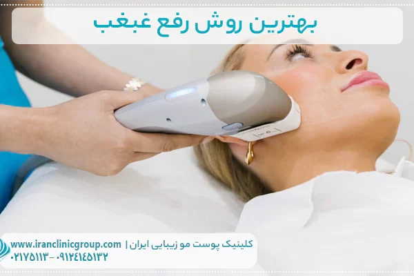 بهترین روش رفع غبغب جدیدترین روش های جراحی و بدون جراحی 1 بهترین روش رفع غبغب