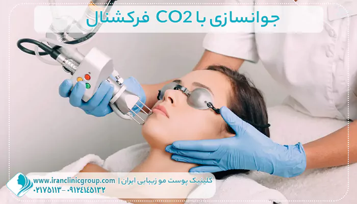 جوانسازی با CO2  فرکشنال