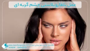 عمل بلفاروپلاستی چشم گربه ای