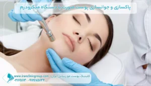 جوانسازی صورت با دستگاه میکرودرم