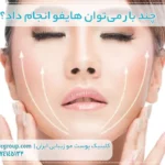 چند بار می‌توان هایفو انجام داد؟