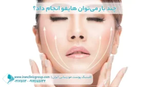 چند بار می‌توان هایفو انجام داد؟