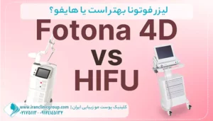 لیزر فوتونا و هایفو