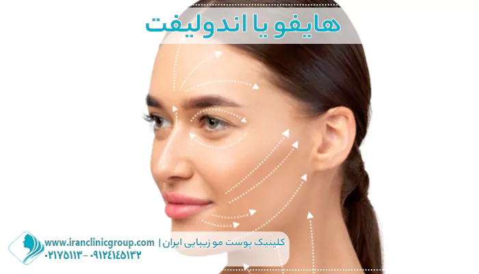 هایفو یا اندولیفت