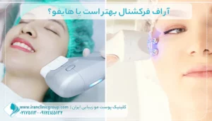 آر اف فرکشنال بهتر است یا هایفو؟