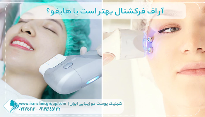 آر اف فرکشنال بهتر است یا هایفو؟